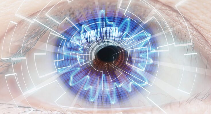 Global Wavefront Lasik Market