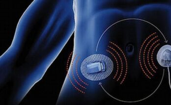 Artificial Pancreas Device Systems