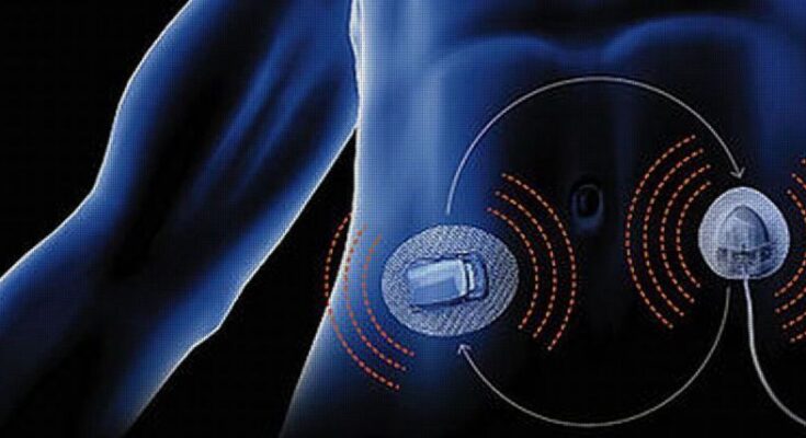 Artificial Pancreas Device Systems