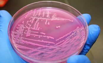 Bacteriological Agar