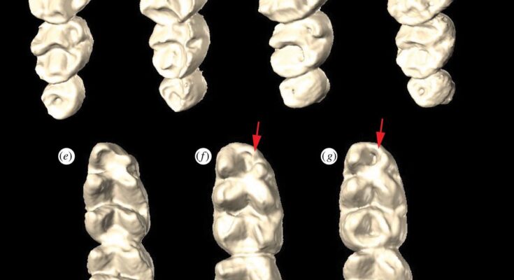 Bone Morphogenetic Protein