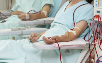 Dialysis Devices