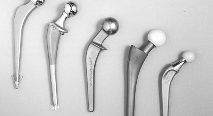 Hydroxyapatite-Coated Femoral Components