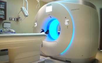 Intraoperative Imaging Global Market