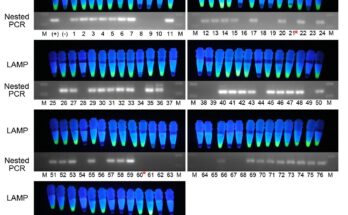 Loop-mediated Isothermal Amplification (LAMP)