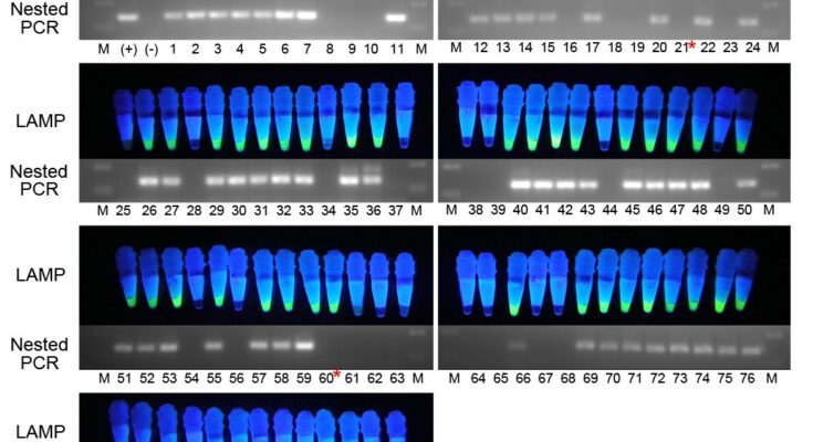 Loop-mediated Isothermal Amplification (LAMP)