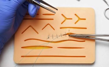 Suture