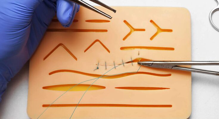 Suture