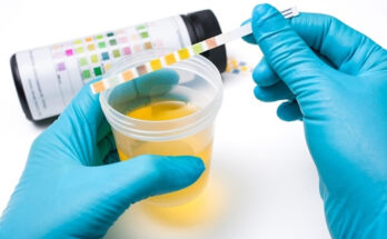 Urinalysis