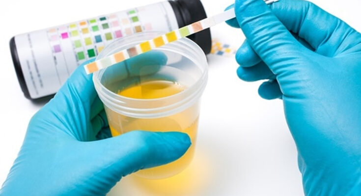 Urinalysis