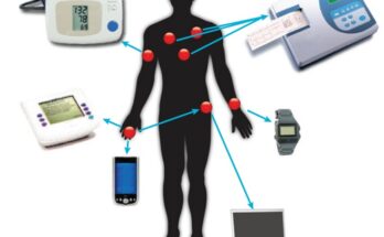 Accelerometers Medical Sensors Market