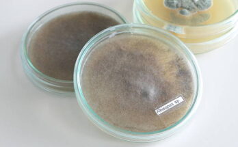 amphoteric surfactants market