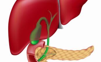 Biliary Atresia Treatment