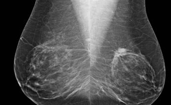 Breast Imaging