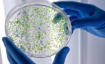 Global Cell Harvesting Market Outlook Through 2023-2032