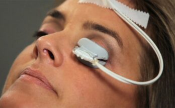 Dry Eye Treatment Devices Market,