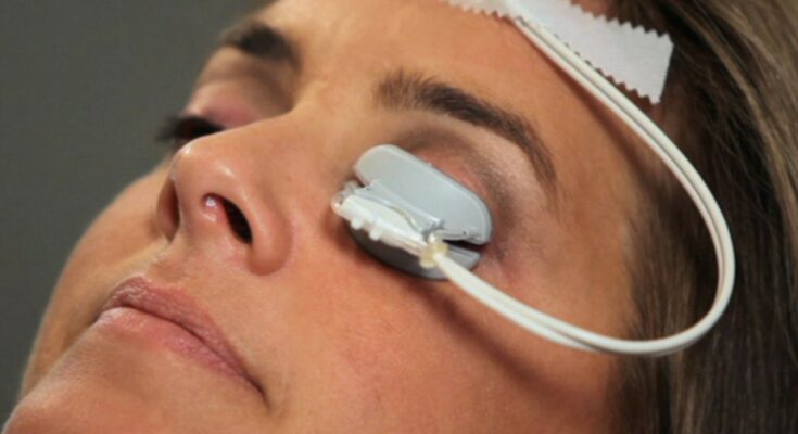 Dry Eye Treatment Devices Market,