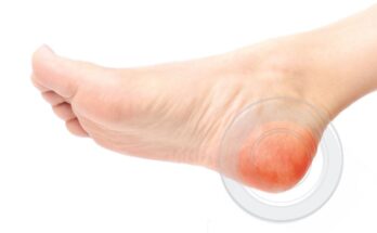 Foot Ulcer Sensors Market