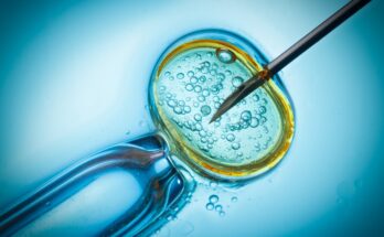 Global Assisted Reproductive Technology