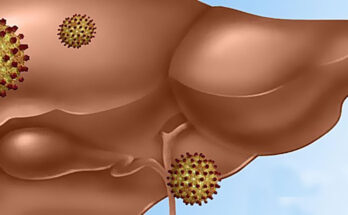 Hepatitis E Diagnostics