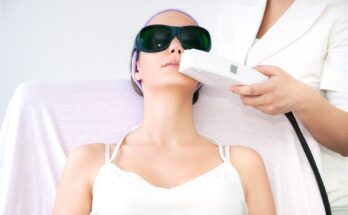 Laser Hair Removal Market