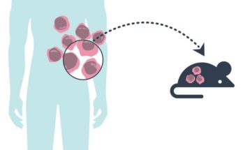 Patient-Derived Xenograft Model