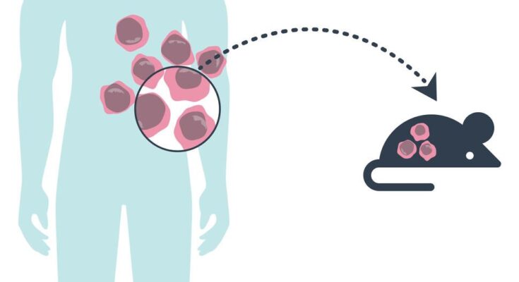 Patient-Derived Xenograft Model