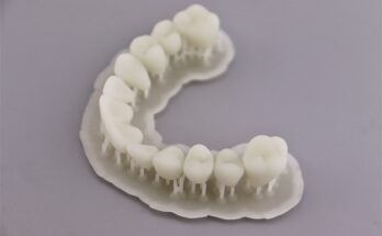 Global Dental 3D Printing Market