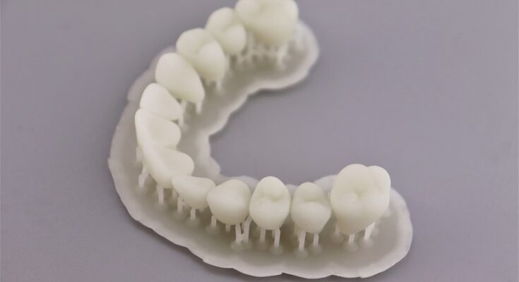 Global Dental 3D Printing Market