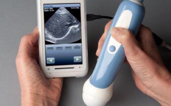 Global Food Ultrasound Market