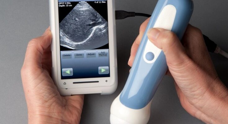 Global Food Ultrasound Market