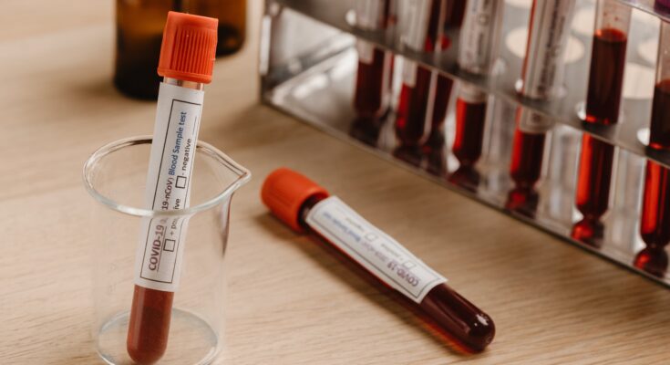 Blood Collection Tubes