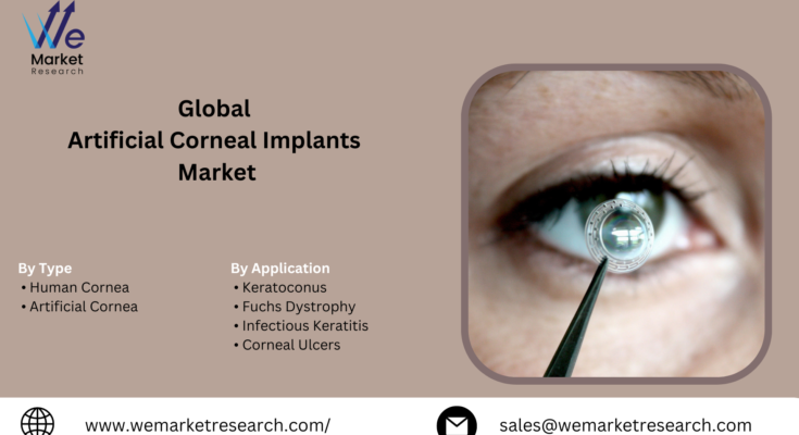 Global Artificial Corneal Implants Market