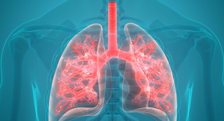 Global Pulmonary Edema Therapeutics Market