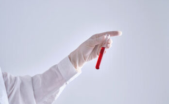 Hemoglobin Testing Market Size