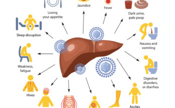 hepatitis c symptoms