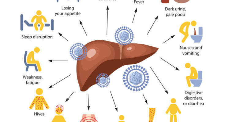 hepatitis c symptoms