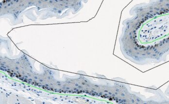 In Situ Hybridization