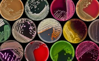 Microbial Cultures Market