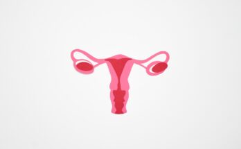 polycystic ovarian syndrome treatment market