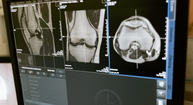 teleradiology market