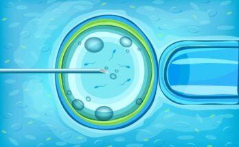 ivf services market