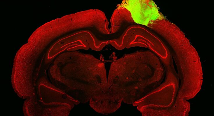 organoids market