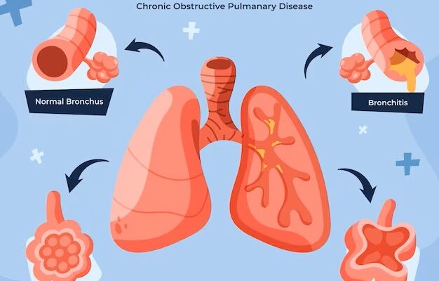 Anti-Asthmatics And COPD Drugs Market Size