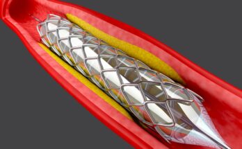 Angioplasty Balloons Market