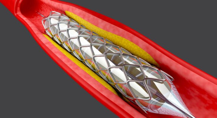 Angioplasty Balloons Market