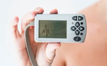 Arrhythmia Monitoring Devices Market Analysis