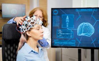 Internal Neuromodulation Devices Market Trends