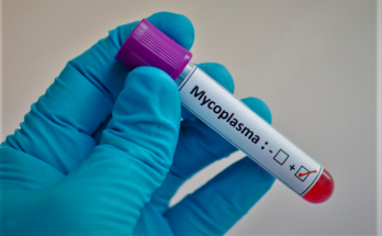 Mycoplasma Testing