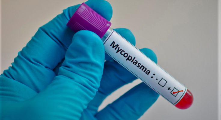 Mycoplasma Testing